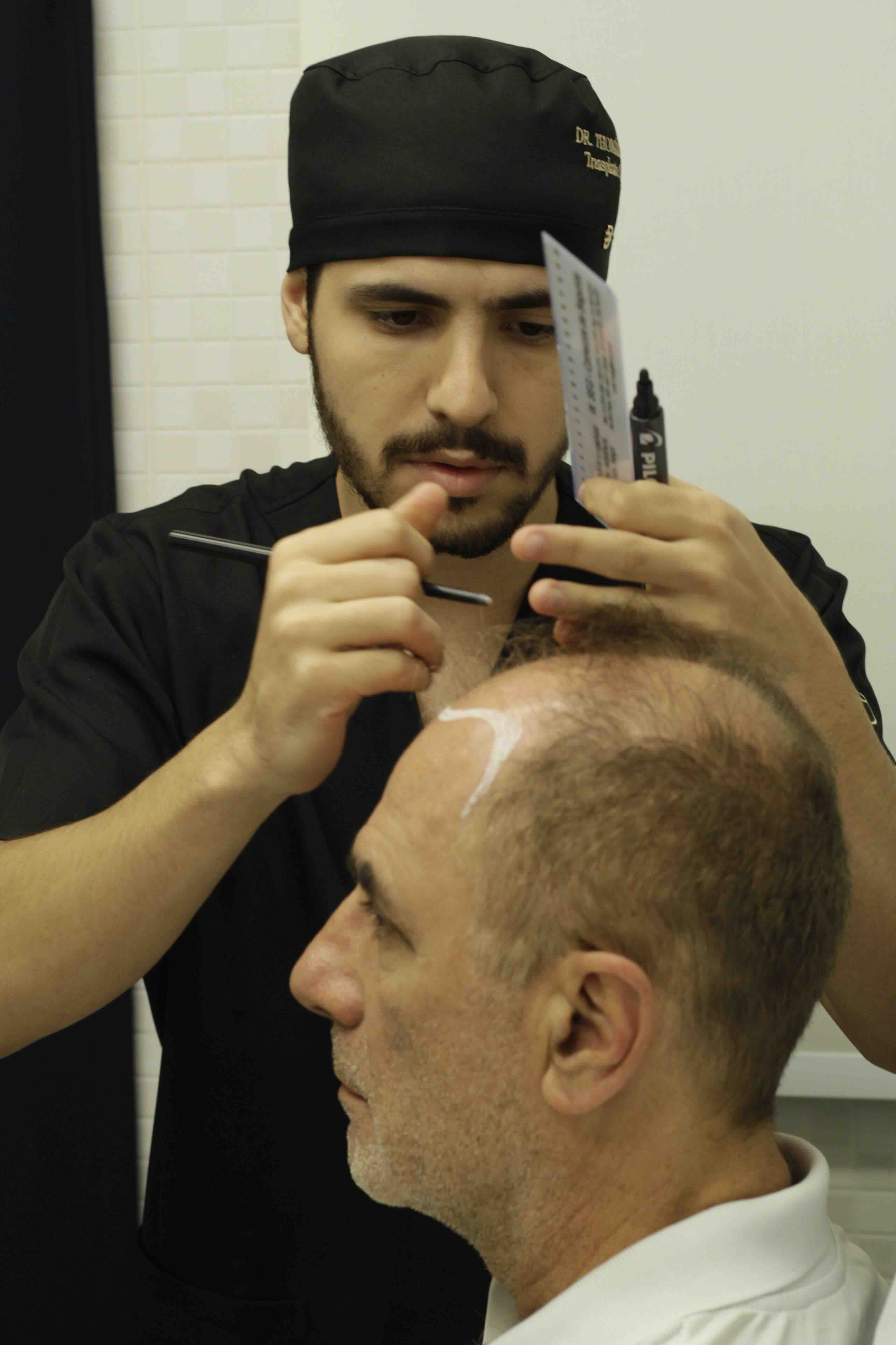 Antes 1